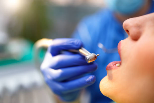 Dental Bonding in Springhill, LA